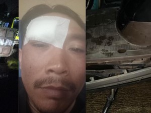 Gegara Jalan Gelap, Driver Ojol di Bandung Tabrak Truk Sampah