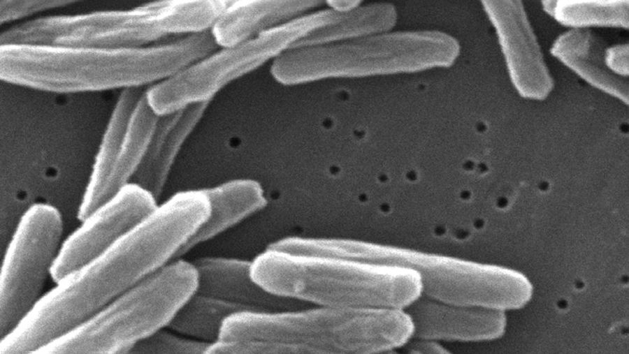 This 2006 electron microscope image provided by the Centers for Disease Control and Prevention shows Mycobacterium tuberculosis bacteria, which causes the disease tuberculosis. (Janice Carr/CDC via AP)