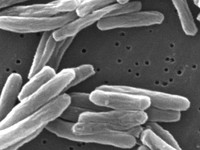 Lebih Mematikan dari Covid, Penyakit Ini Susah Hilang dari RI