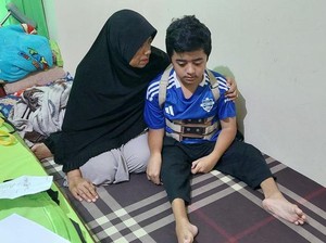 Yuk Bantu Kiki, Remaja Penderita Tulang Rapuh yang Sudah 16 Kali Operasi