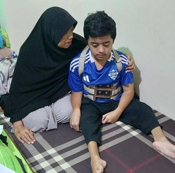 Kiki Penderita Kerapuhan Tulang, Jalani 16 Kali Operasi Sejak Balita