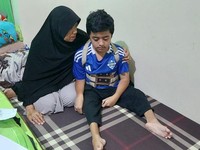 Kiki Penderita Kerapuhan Tulang, Jalani 16 Kali Operasi Sejak Balita