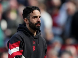 Gelar Juara MU Disamai Liverpool, Amorim Singgung Siklus