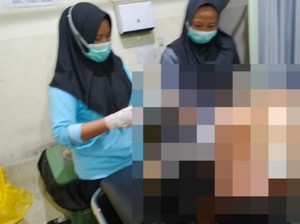 Ajakan Rujuk Ditolak Berujung Sugianto dengan Brutal Bacok Siti Romlah