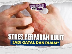 Video Mitos atau Fakta: Stres Tekanan Pekerjaan Memicu Eksim Kulit Lebih Parah