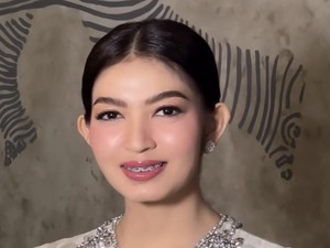 Kini Pakai Behel, Gaya Selvi Ananda Manglingi Dengan Riasan Serba Pink