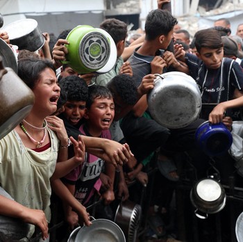 Potret Terkini Anak-Anak Gaza, Kondisinya Bikin Merinding
