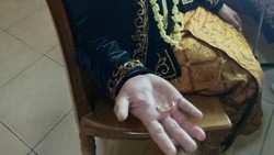 Cincin Manten Pria Bikin Jari Bengkak, Damkar Sukoharjo Turun Tangan