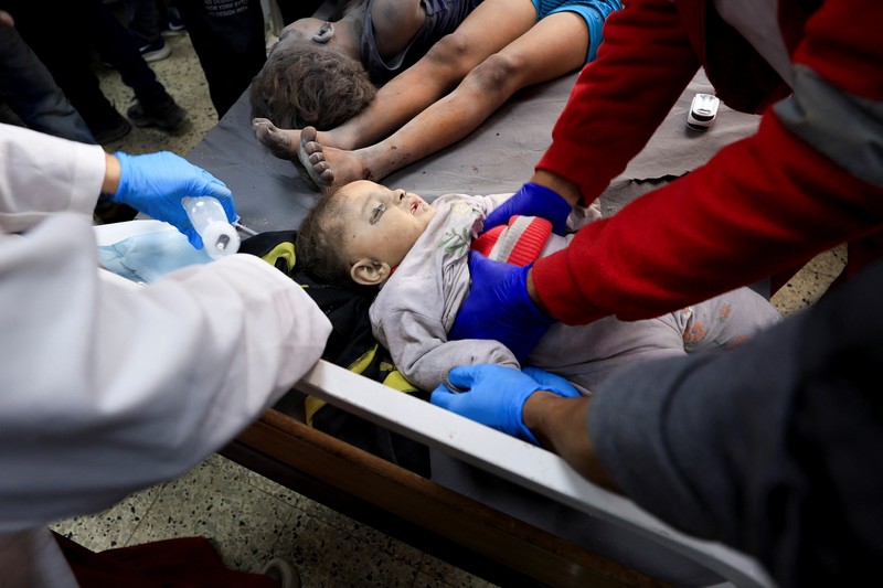 Anak Palestina Osama Al-Reqep, 5 tahun, terbaring di ranjang di Rumah Sakit Nasser tempat ia menerima perawatan, di Khan Younis, di Jalur Gaza selatan, 1 Mei 2025. (REUTERS/Hatem Khaled)