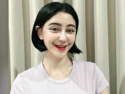 Uut Permatasari Mantap Facelift, Tinggalkan Tarik Benang Uut Permatasari Mantap Facelift, Tinggalkan Tarik Benang