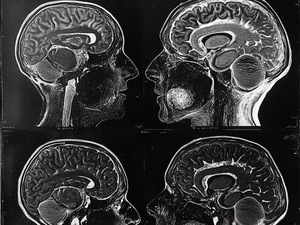 Cognitive Debt: Utang Kognitif, Akibat Otak yang Jarang Dipakai