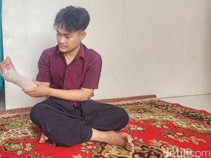 Cerita Marbot Masjid Saat Dibegal: 3 Kali Dibacok, 2 Berhasil Menghindar