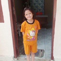 Hampir Setahun di RS, Putri Berjuang Sembuh dari Penyempitan Usus