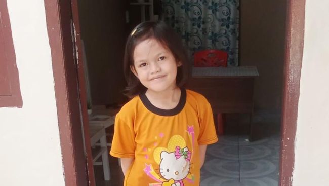 Hampir Setahun di RS, Putri Berjuang Sembuh dari Penyempitan Usus