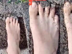 Viral Kaki Dikerumuni Semut Disebut Jadi Tanda Diabetes, Ini Kata Dokter