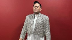 Lesti Kejora Kesandung Kasus Hak Cipta, Doa Mengalir Deras dari Nassar