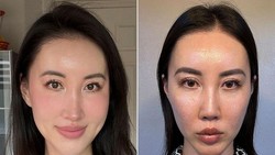 Viral Wanita Jalani 5 Kali Operasi Hidung karena Bosan dengan Wajahnya
