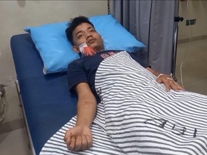 Indra Terkena Anak Panah di Palembang, Polisi: Terlibat Tawuran