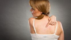 Stevens-Johnson Syndrome (SJS)