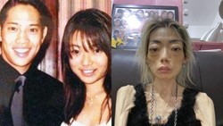 Diet Ekstrem, Model Hong Kong Ini Berbobot 22 Kg, Ditinggal Suami Konglomerat
