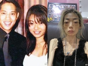 Mantan Model Hong Kong Diet Mengerikan, Pemicunya Kata-kata Suami Saat Makan