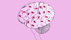 Pilu Terserang Stroke di Umur 21, Ini 6 Kebiasaan yang Bisa Jadi Pemicu