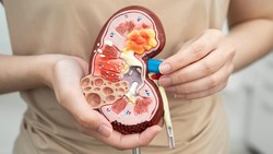 Jari Tangan Wanita Ini Terpaksa Diamputasi, Berawal dari Keluhan Batu Ginjal