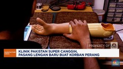 Video: Klinik Super Canggih Bantu Korban Perang Dapat Lengan Baru