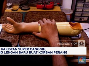 Video: Klinik Super Canggih Bantu Korban Perang Dapat Lengan Baru