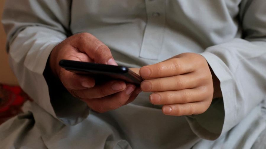 Perusahaan rintisan Pakistan membuat dan mengirimkan prostetik ke anak-anak penyintas perang. (REUTERS/Akhtar Soomro)