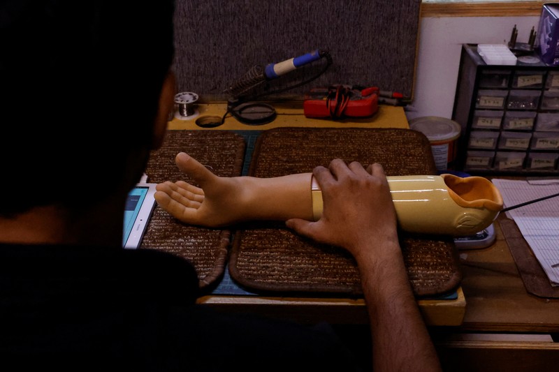 Perusahaan rintisan Pakistan membuat dan mengirimkan prostetik ke anak-anak penyintas perang. (REUTERS/Akhtar Soomro)