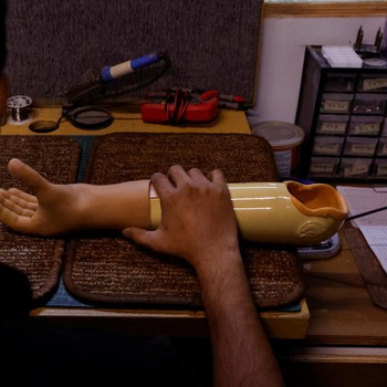 Klinik Pakistan Super Canggih, Pasang Lengan Baru Buat Korban Perang