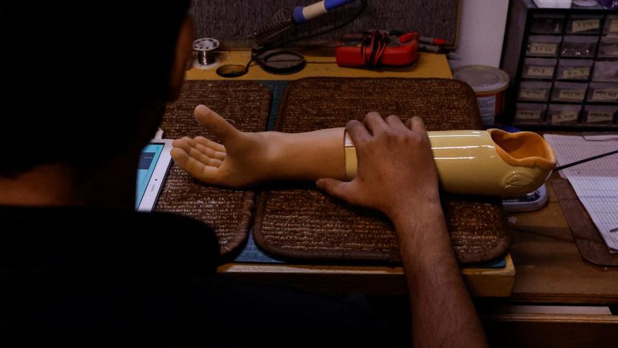 Perusahaan rintisan Pakistan membuat dan mengirimkan prostetik ke anak-anak penyintas perang. (REUTERS/Akhtar Soomro)