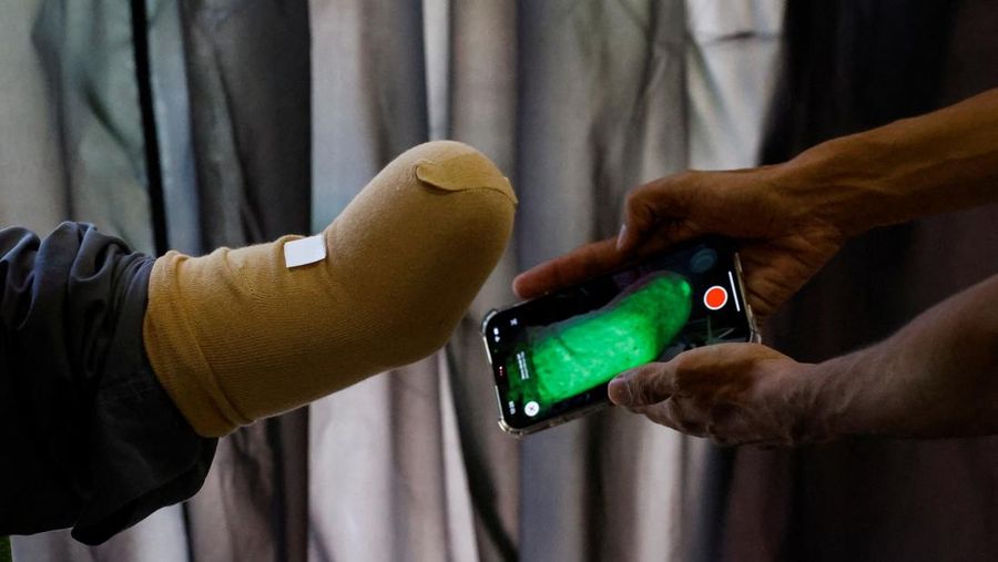 Perusahaan rintisan Pakistan membuat dan mengirimkan prostetik ke anak-anak penyintas perang. (REUTERS/Akhtar Soomro) Perusahaan rintisan Pakistan membuat dan mengirimkan prostetik ke anak-anak penyintas perang. (REUTERS/Akhtar Soomro)