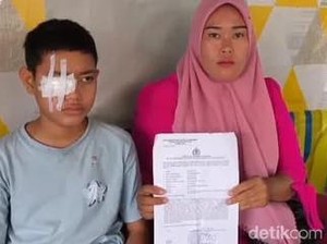Siswa SMP di Gowa Kena Ketapel Tusuk Bakso di Mata Kanan, Ortu Lapor Polisi