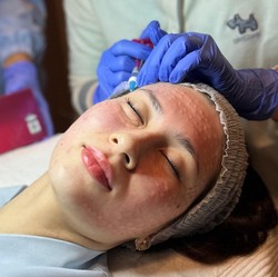 Rahasia Kulit Glowing di Blink Beauty Clinic: Canggih & Terjangkau