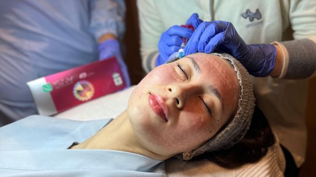 Rahasia Kulit Glowing di Blink Beauty Clinic: Canggih dan Terjangkau