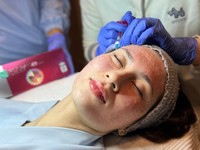 Rahasia Kulit Glowing di Blink Beauty Clinic: Canggih & Terjangkau