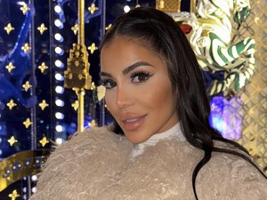 Posting Wajah Berdarah, Beauty Influencer Ceritakan Diserang Perampok