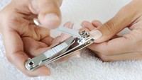 Kuku Menghitam atau Bernanah Gara-gara Cantengan? Ini Serum yang Bisa Bantu 