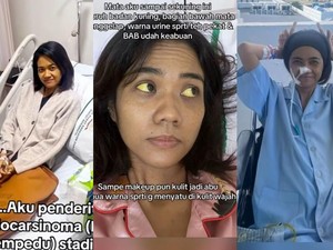 Kronologi Wanita Samarinda Kena Kanker Saluran Empedu Stadium 4 di Usia 38