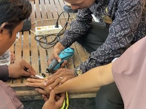 Cincin Tak Bisa Dilepas, Wanita di Bima Minta Bantuan Damkar