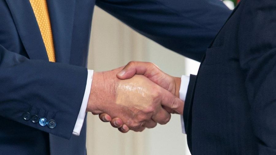  Make-up partially covers the back of the right hand of U.S. President Donald Trump as he speaks to members of the media upon his arrival from Pennsylvania, at Joint Base Andrews, Maryland, U.S., July 15, 2025. In a July 17, 2025 press briefing, U.S. Press Secretary Karoline Leavitt read a statement from his doctor that President Trump has a chronic venous insufficiency