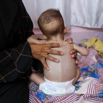 Potret Horor Bencana Kelaparan Selimuti Gaza, bak Neraka di Bumi