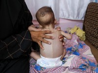 Potret Horor Bencana Kelaparan Selimuti Gaza, bak Neraka di Bumi