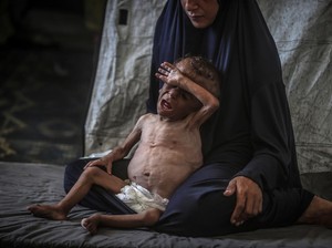 Hal Mengerikan yang Terjadi Pada Tubuh Lapar Anak-anak Gaza