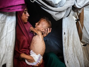 Miris! Kelaparan Membuat Anak-anak Gaza Tak Kuat Lagi Menangis