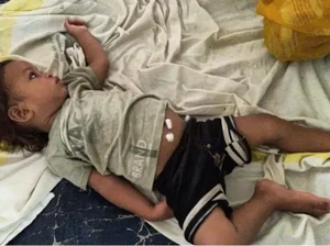 Bayi Ajaib Jadi Seleb Gegara Gigit Kobra Sampai Mati