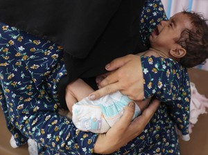 WHO: 99 Orang di Gaza Alami Malnutrisi, 29 Masih Balita