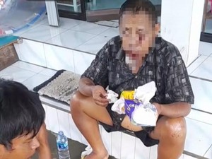 Sempat Bangun dan Bicara Setelah Diserempet Truk, Pria di Karangasem Tewas